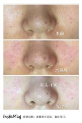 光SPA水氧＋opt-光SPA科技美肤