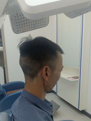 -大麦微针植发全国连锁