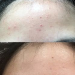 -苗方清颜痘肌研究所