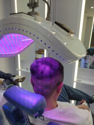 体验后-大麦微针植发全国连锁