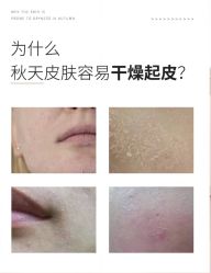 -安那般那皮肤年轻化ANAPANA