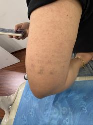 -英刺青 纹身 洗纹身