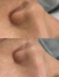 -SKIN79皮肤管理中心