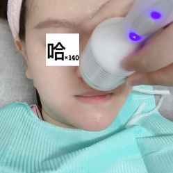 -KS科逆美肤祛痘