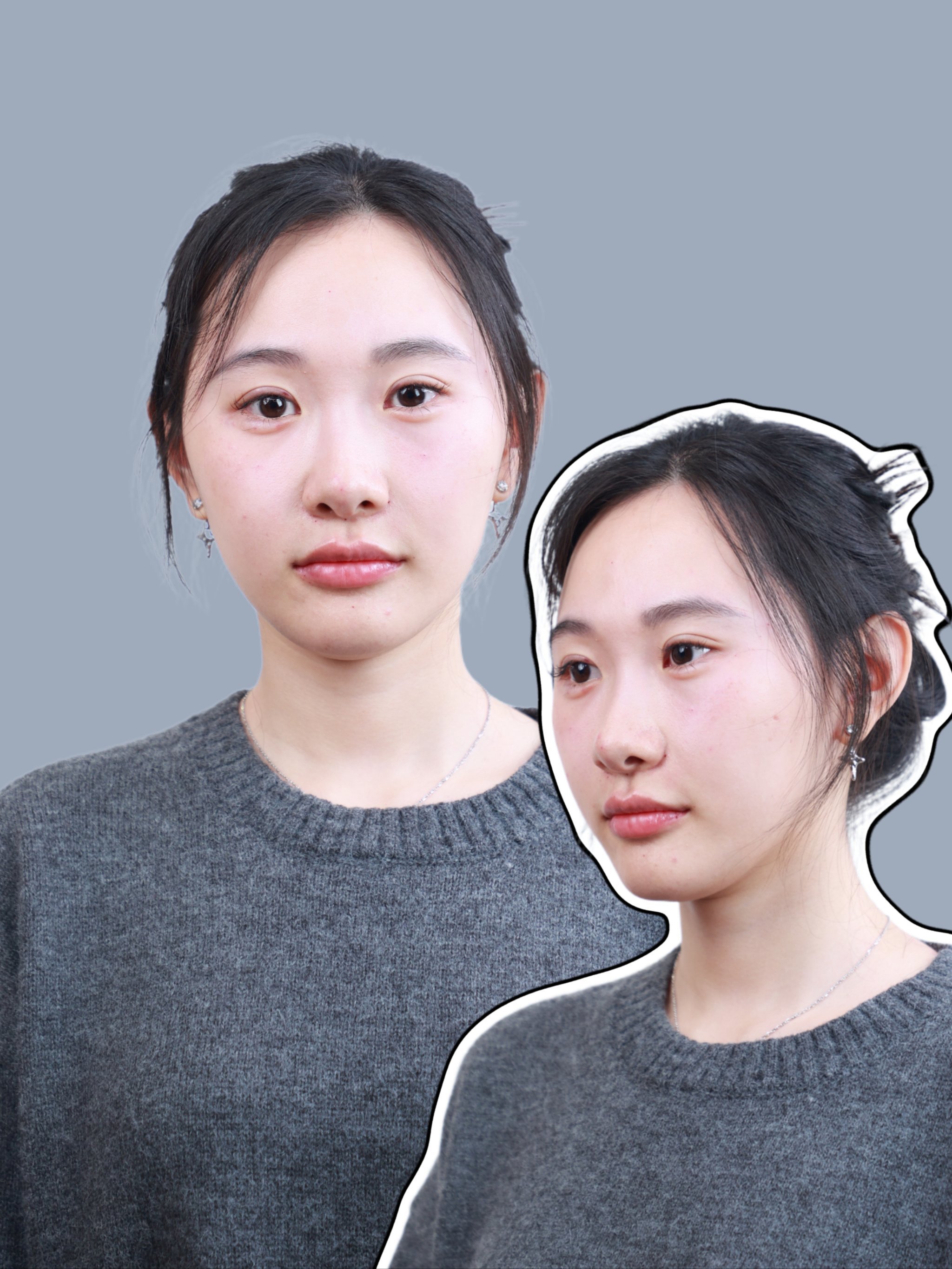 👀0整感的变美微调就是这样子的吧