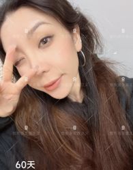 -北京米扬丽格医疗美容·联合丽格鼻整形中心