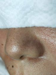 -SKIN MOLY魔力之肌皮肤管理中心