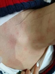 -痣清宫祛斑祛痣连锁店