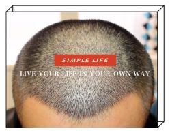 -大麦微针植发全国连锁