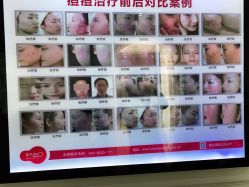 点击看大图 -苗方清颜痘肌研究所