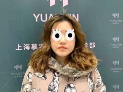 体验后-媛音医美