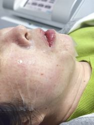 -长沙雅美医疗美容医院