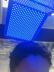 -碧莲盛·不剃发植发