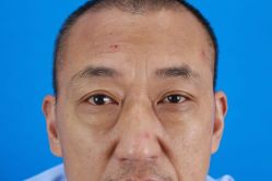 -万州华美紫馨整形美容医院