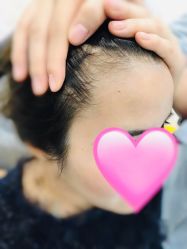 -八大处整形