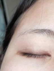 体验后-西安壹加壹医疗美容·西北抗衰旗舰店