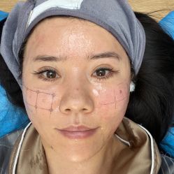 -北京润美玉之光医疗美容