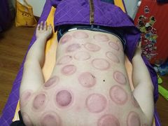 -沈师傅盲人按摩工作室(密三小区店)