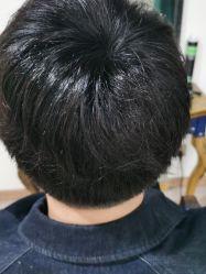 点击看大图 -极客侠男士假发定制补发