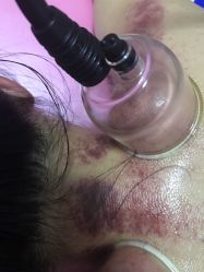 -碧波庭胸部保养养生馆