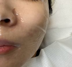 -佳慕·痘痘·问题肌管理中心