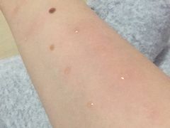 -大连市皮肤病医院