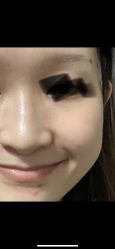 体验后-杭州医巢医疗美容