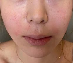 -天津健丽·去眼袋医疗美容机构