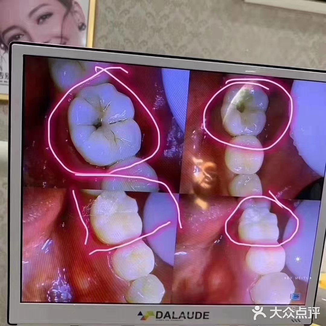 定期洁牙给你带来的意外和惊喜