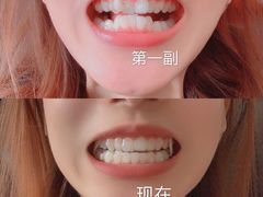 -深圳佑诺口腔门诊部