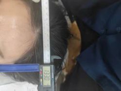 -颜和骨正·明哲式骨相美学整骨