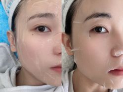 体验前-联合丽格·张菡丽格医疗美容