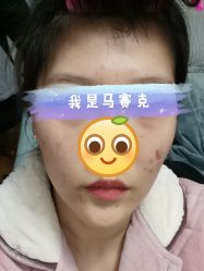 体验后-Yestar艺星医疗美容医院