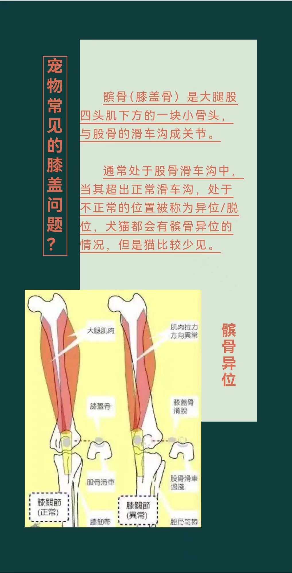 腿窝的位置示意图图片