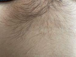 -咪咪专业脱毛连锁机构