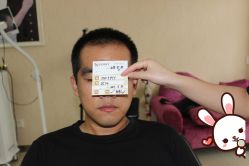 -大麦微针植发丨全国连锁