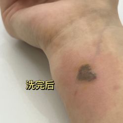 体验后-杭州奥拉克医疗美容门诊部
