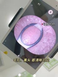 -凡碧诗毛孔清洁收细