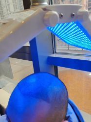 -碧莲盛·不剃发植发