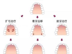 -团圆口腔·种植中心(锦江院区)
