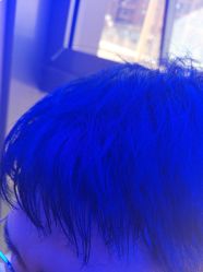 -碧莲盛·不剃发植发