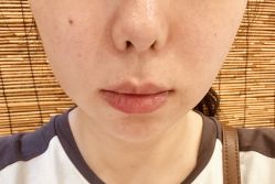 -重庆星宸整形美容医院
