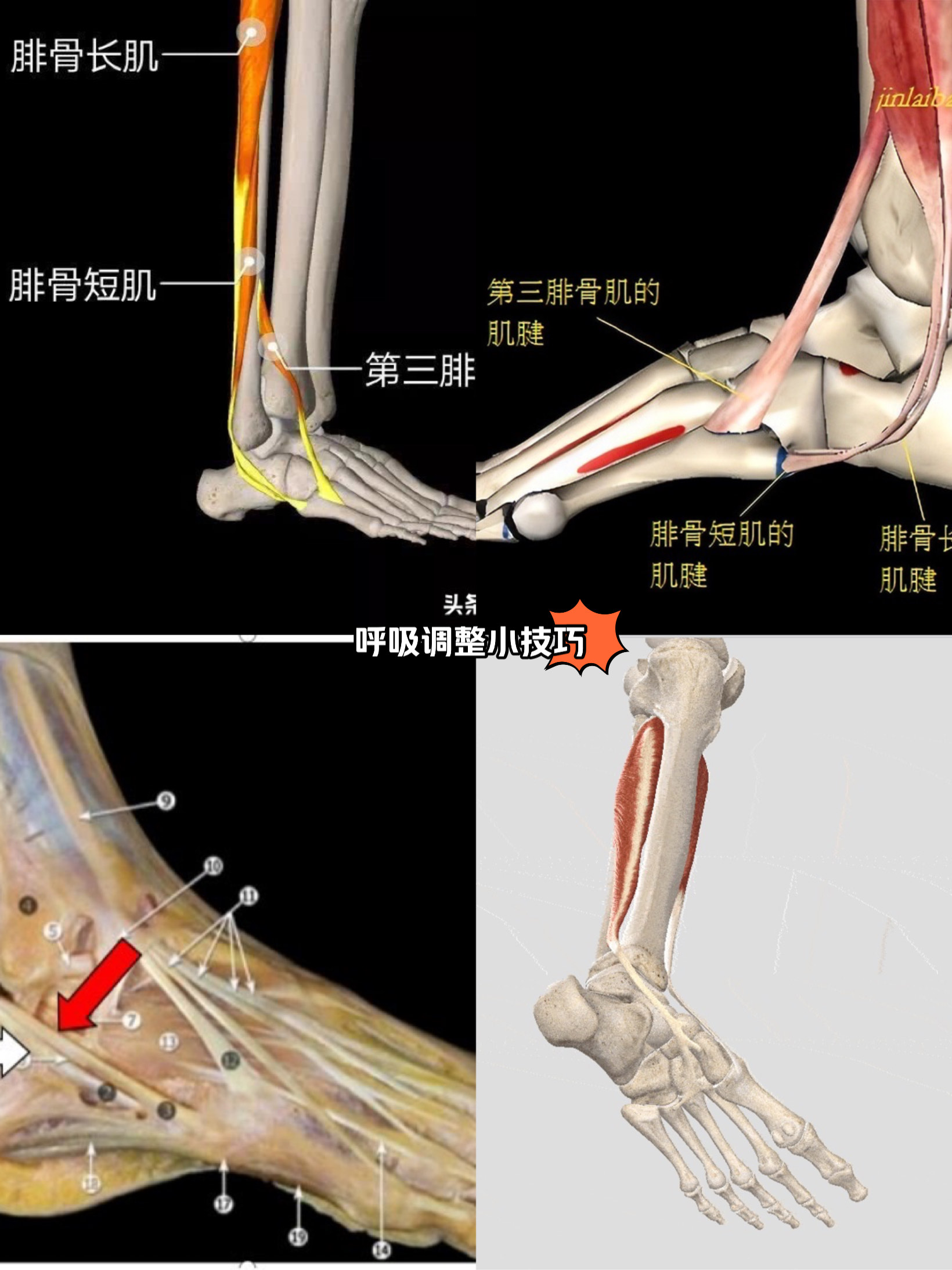 腓骨长肌痛图片