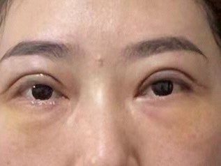 点击看大图 -长沙雅美医疗美容医院