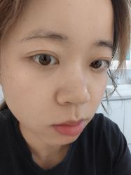 体验后-Dr.U博士医疗美容医院