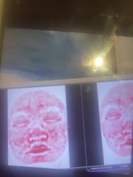 点击看大图 -苑苑vbeauty科技美容SPA