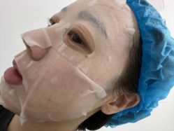 -agge蛋白医美