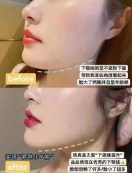 -YooMee优美智能科技美肤机构