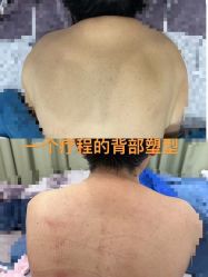 -Lily纤美·科技减脂中心