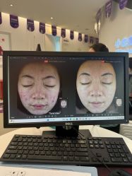 点击看大图 -小忠丽格医美